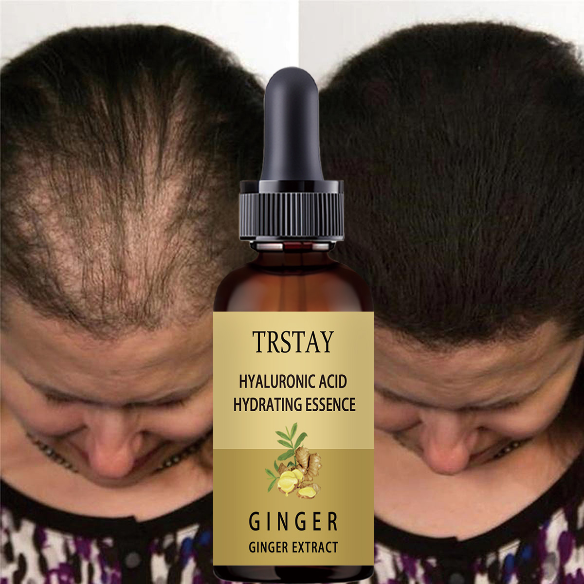 Hair Care Gisou - Sérum de croissance des cheveux, Anti-chute,