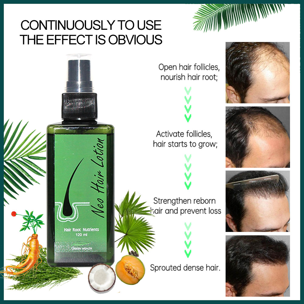 Original Neo Lotion capillaire - Hair Care Gisou avis et prix