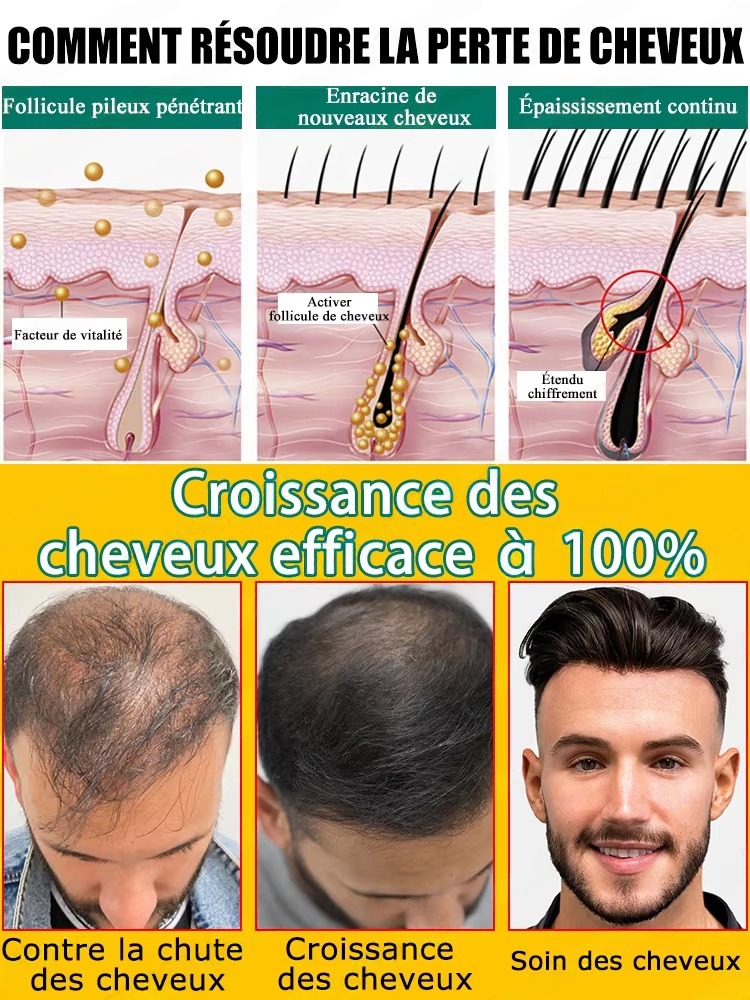 Complément aux soins quotidien - Hair Care Steps avis et prix